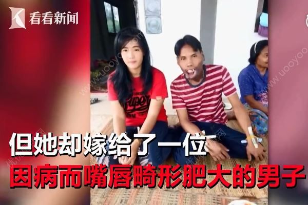 美女離婚改嫁畸形嘴丑男，前夫指責“她一定是為了錢”(2)