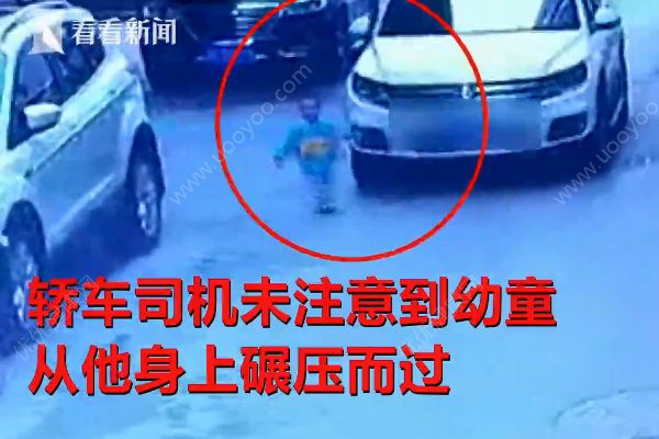 幼童玩躲貓貓慘遭轎車碾壓，危在旦夕，警方已介入(1)