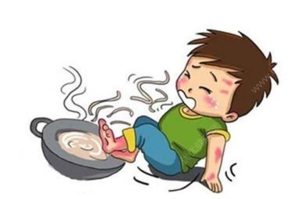 4歲男孩一屁股坐進(jìn)開水桶，全身65%燙傷，燙傷急救處理方法(1)