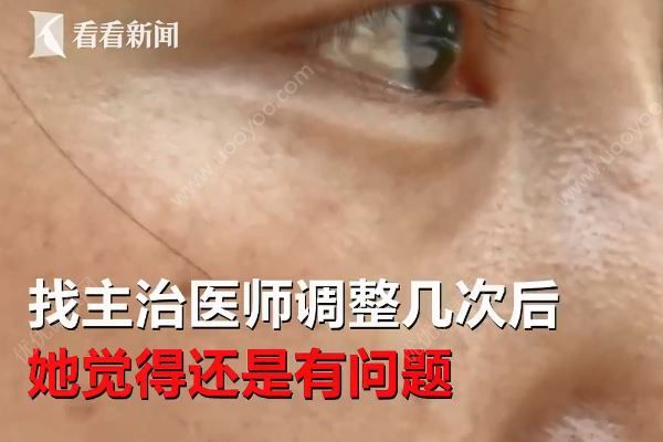 女子整容后一下子老了十多歲，醫(yī)院稱自己資質(zhì)合法(4)