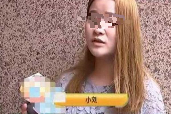 女子花5300元割雙眼皮，3年后想退款：左眼是四眼皮(2)