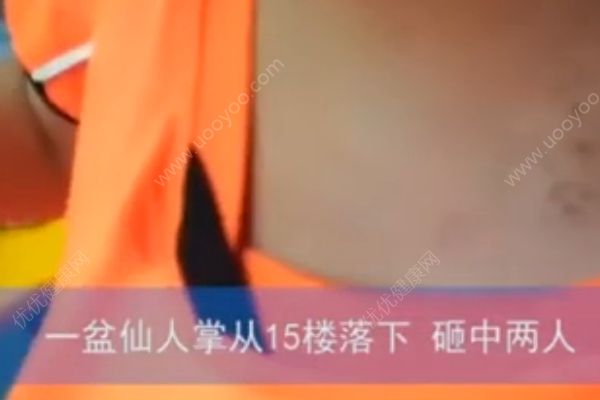 仙人掌從15樓掉落，男孩身上多處被砸成馬蜂窩(2)