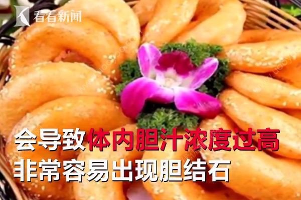 愛吃油炸長468顆結(jié)石，油炸食品的危害有哪些？(3)