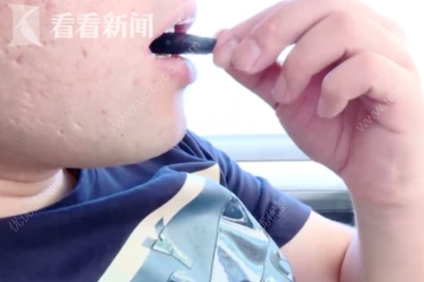 男子每天吃5包檳榔連吃10年患癌，長(zhǎng)期吃檳榔小心口腔癌！(1)