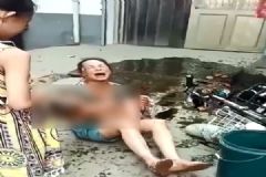 電動(dòng)車撞翻早餐攤油鍋，1歲半男娃被熱油從頭澆下[多圖]