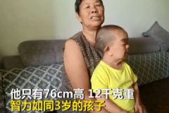 48歲兒子僅76厘米3歲智商永遠(yuǎn)"長不大" 71歲母親不敢撒手[多圖]