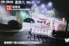 男子圍觀情侶吵架，被咬掉鼻尖，情侶間如何避免吵架？[多圖]