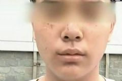 打籃球13歲少年被抓成花臉，如何解決廣場舞擾民問題[多圖]