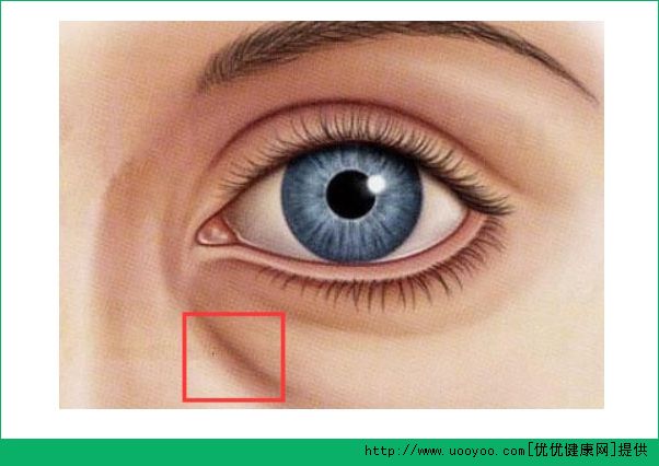 臥蠶和黑眼圈有什么區(qū)別？臥蠶和眼袋有什么區(qū)別？(4)