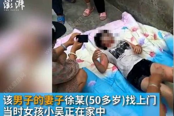 17歲少女在家被人用開水灌喉，嫌犯疑為母親