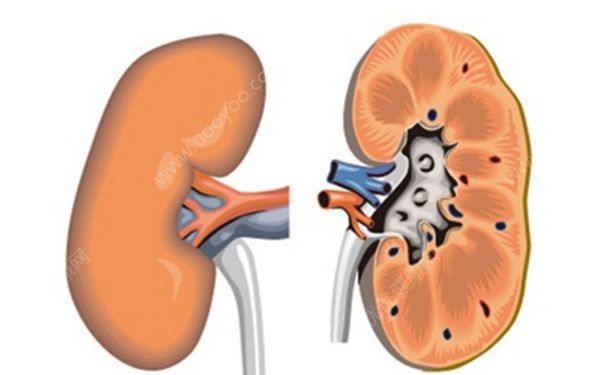 腎囊腫是怎么回事？腎囊腫治療方法(1)