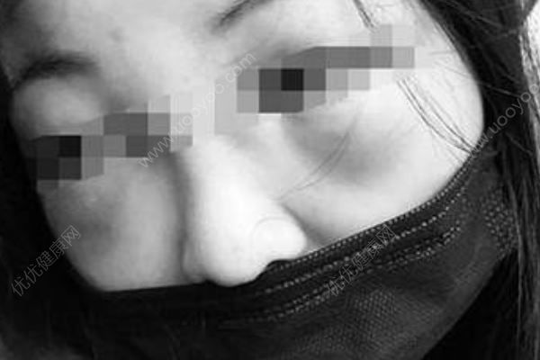 女生打呼嚕遭群毆致耳膜穿孔，打鼾自我治療小竅門(2)