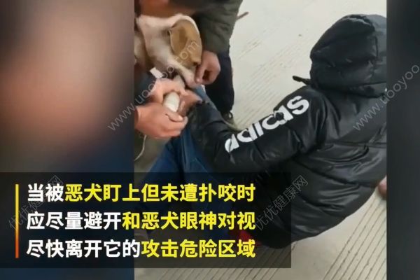 惡犬撲咬無路逃！下一步你該咋辦？(1)