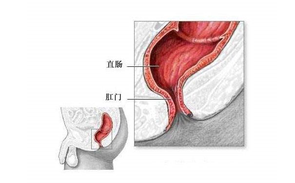 冬天拉屎大便出血怎么回事？冬天便血飲食調(diào)理方法(2)