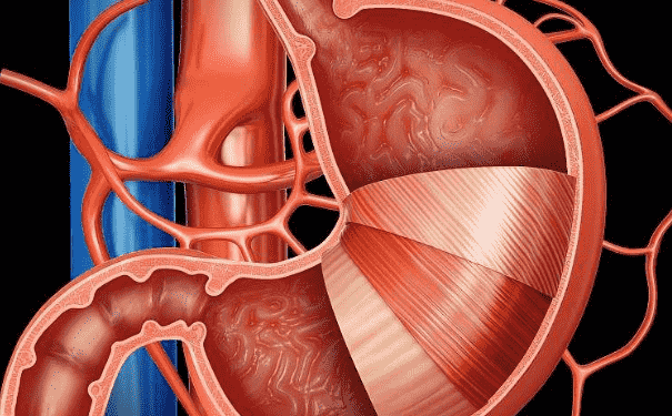 胃癌患者切除胃后怎么吸收營養(yǎng)？切除胃后吃什么好？(1)