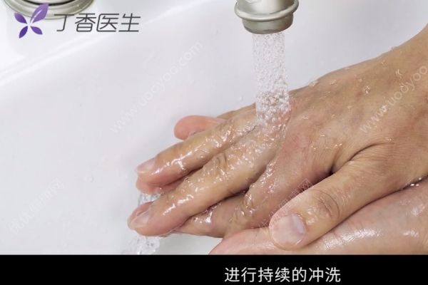 為治感冒給孩子蒸足燙傷，燙傷如何緊急處理？(2)