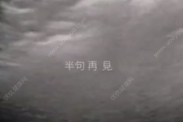 孫燕姿曬二胎寶寶B超視頻做新歌預(yù)告，懷二胎要注意什么？(3)