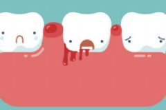 牙齦出血的治療方法有哪些？牙齦出血的注意事項(xiàng)有哪些？[圖]