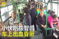 小伙剛拔完智齒，坐公交車(chē)血流一地，嚇壞一車(chē)人[多圖]