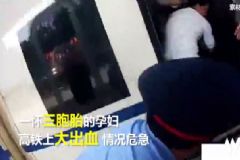 三胞胎孕婦火車上大出血，孕婦大出血該怎么辦？[多圖]