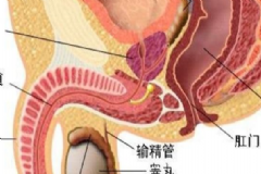 有效預防睪丸炎的方法有哪些？預防睪丸炎有什么好方法？[圖]