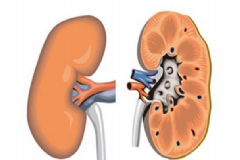 腎炎該怎么治療最好？腎炎有傳染性嗎？[圖]