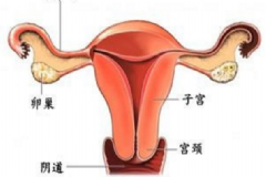 附件炎如何根治？附件炎是怎么引起的？[圖]