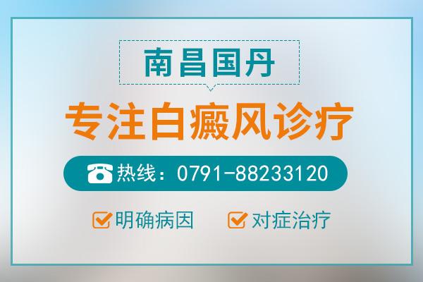 南昌國(guó)丹醫(yī)院怎么樣？治療白癜風(fēng)正常大概花多少錢？