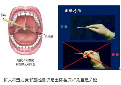 核酸檢測新冠病毒的常用手段：口腔拭子、鼻腔拭子檢測圖解