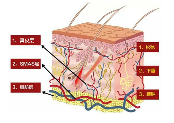 什么是赫本線？聯(lián)合麗格向淑英抗衰新理念：45°赫本線緊致術