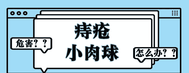 天津歐亞肛腸醫(yī)院解答：外痔瘡肉球摸著別扭，發(fā)作起來疼痛，怎么消除？