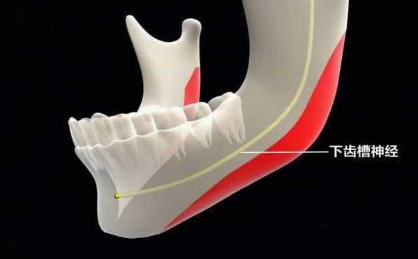 聯(lián)合麗格第一醫(yī)院何照華教授：下頜角手術(shù)會不會損傷神經(jīng)線？
