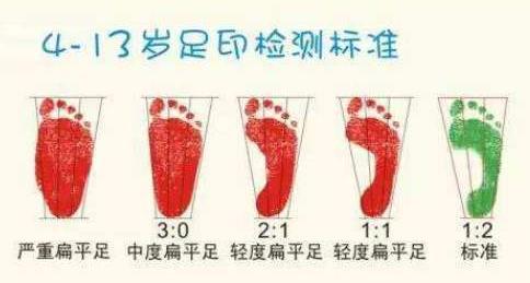 扁平足能跑步嗎？扁平足跑步有什么危害？