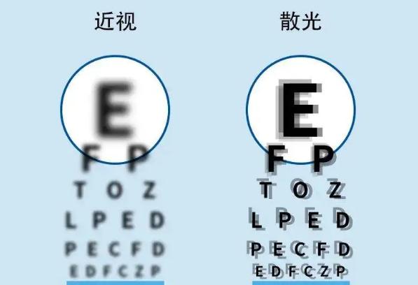 散光的癥狀有哪些？散光可以戴隱形眼鏡嗎？