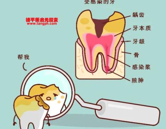 牙周炎能自愈嗎 局部用藥定期治療刷牙