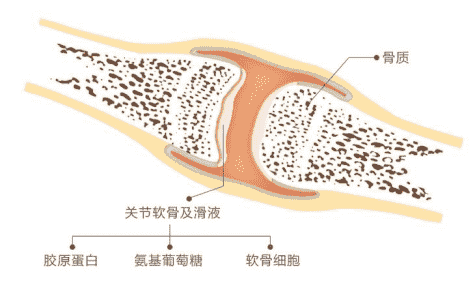 日常養(yǎng)護(hù)關(guān)節(jié)軟骨，有哈藥氨糖幫忙更高效