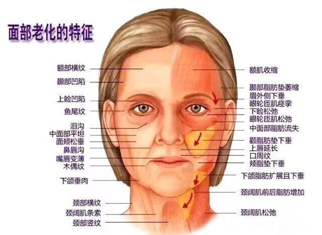  北京煤醫(yī)副主任王馳：TER時光定格術(shù)為什么聯(lián)合吸脂？