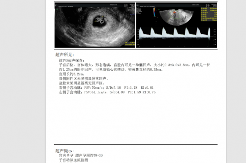 年近不惑苦求二胎，陳怡主任幫她圓夢升級