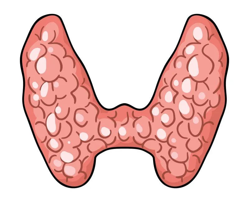 當(dāng)心！成都民生耳鼻喉醫(yī)院：身體有這幾種表現(xiàn)，說(shuō)明你的甲狀腺出了問(wèn)題！
