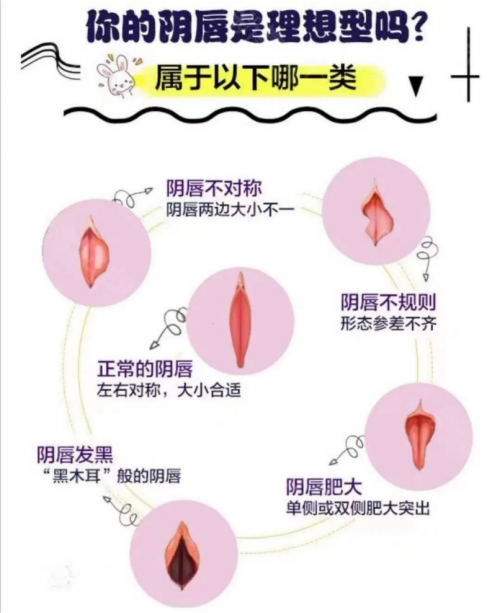 昆明做陰唇整形會留疤嗎？多久能恢復(fù)呢？