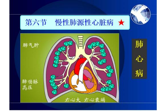 冠心病是心臟病嗎？什么是肺源性心臟病？