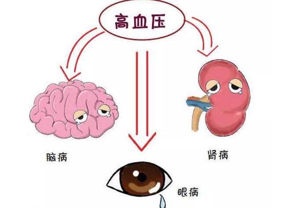 高血壓有哪幾種類型？高血壓要做些什么檢查項目？