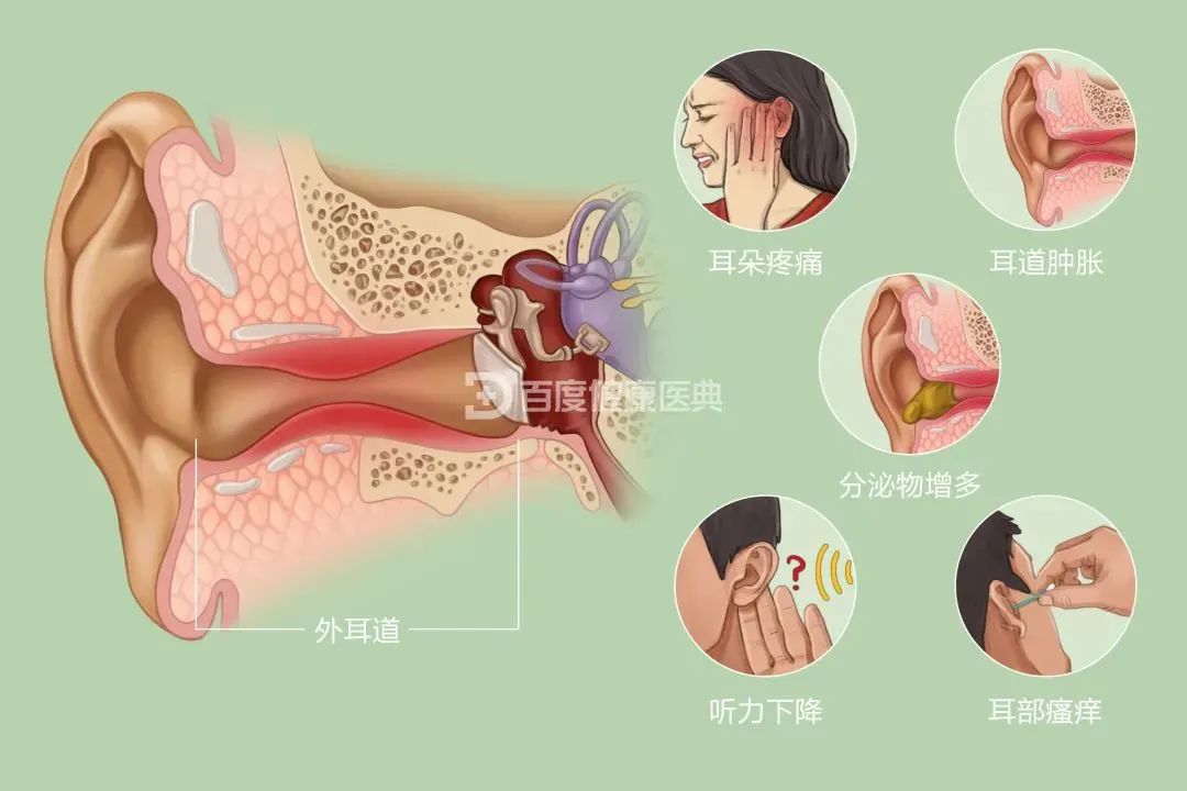 兒童患”流感“為什么會耳朵疼？成都民生耳鼻喉醫(yī)院專家解答原因 國家三級醫(yī)院