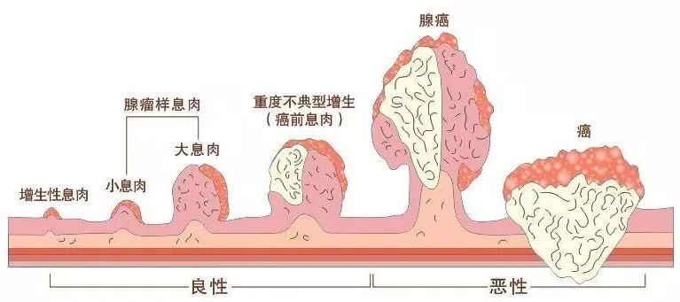  揚州妙手醫(yī)院睡眠式無痛胃腸鏡檢查，不僅準(zhǔn)確，而且“快速”