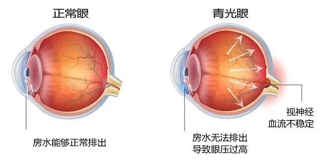 株洲愛(ài)爾代敏丨為“獨(dú)眼”女子守住最后一絲光明！