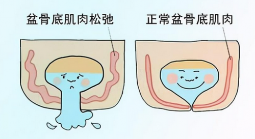 在昆明關(guān)于陰道松弛，你一定要知道的這些問題