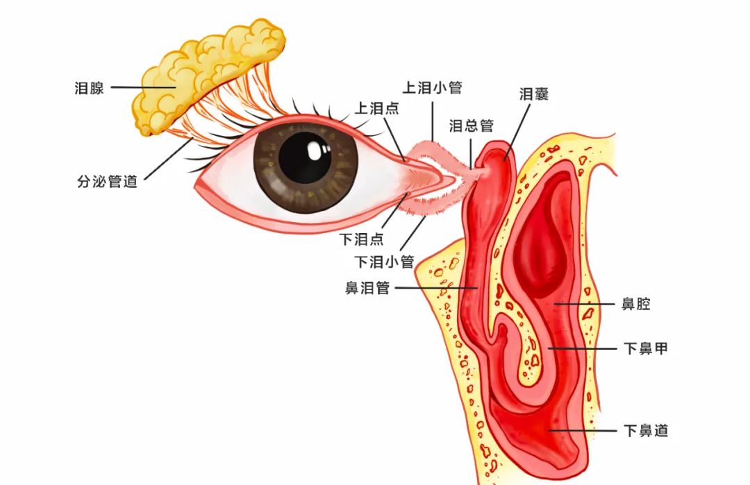 合肥愛爾眼科：女孩流淚8年？！原來是淚道堵塞！