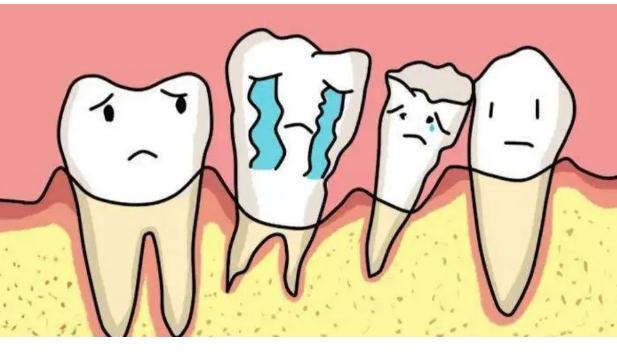 哪些牙齒需要拔掉？含氟牙膏對(duì)牙齒的作用？