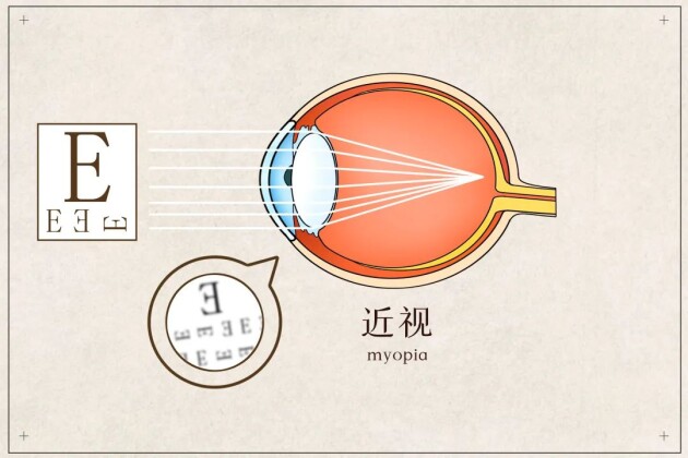 【直播預(yù)告】開學(xué)第一課，名醫(yī)名師教你近視管理和專注力提升，以最佳狀態(tài)為新學(xué)期開篇！