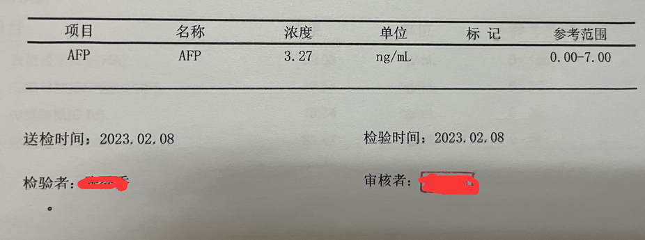 濟(jì)南中醫(yī)肝病醫(yī)院陳士俊教授解答:做什么檢查能早點(diǎn)發(fā)現(xiàn)肝癌?